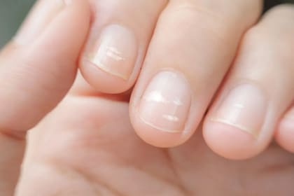 Los significados de las rayas en las uñas que suelen aparecerle a muchas personas