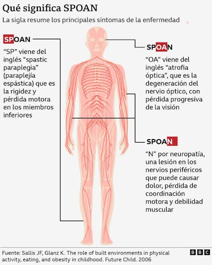 Los síntomas de la enfermedad están resumidos en la sigla que le da el nombre.