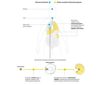 Los síntomas del coronavirus