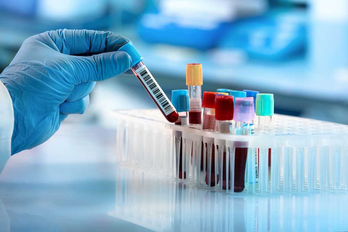 Los test rápidos que ordenó retirar el gobierno porteño estaban destinados a establecimientos médicos y geriátricos de la ciudad