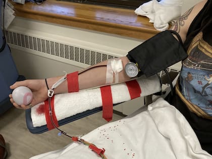 Los trasplantes de células madre, también conocidos como trasplantes de médula ósea, se usan para tratar a pacientes con leucemia, linfoma, enfermedad de células falciformes y otros trastornos