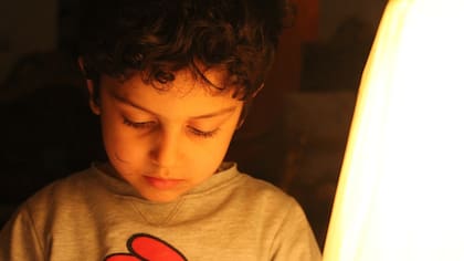 Los trastornos del espectro autista son cuatro veces más frecuentes en varones que en mujeres