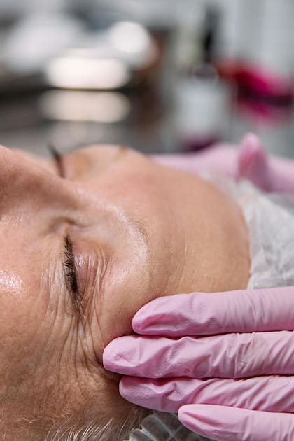 Los xantomas pueden reducirse con el control adecuado del colesterol