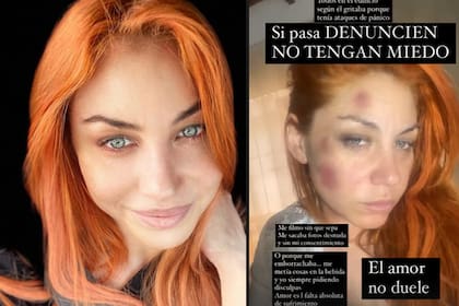 Lourdes Fernández, integrante del grupo Bandana, acusó a su expareja de golpearla