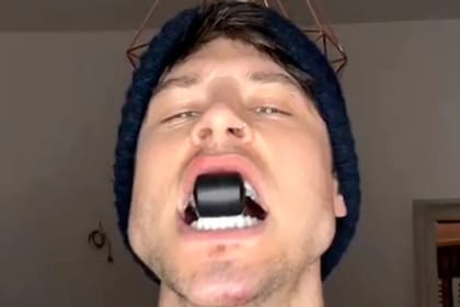 Luca Marchesi dice haber transformado su mandíbula con tres meses de ejercicios y ahora mostró cómo lo logró