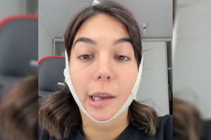 Luciana Milessi reveló por qué tiene una paralisis facial (Captura video)