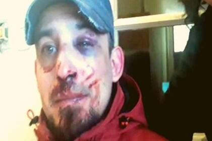 Luciano González sacó a pasear a su bóxer en la madrugada del martes pasado y la policía lo interceptó y lo agredió, según su denuncia