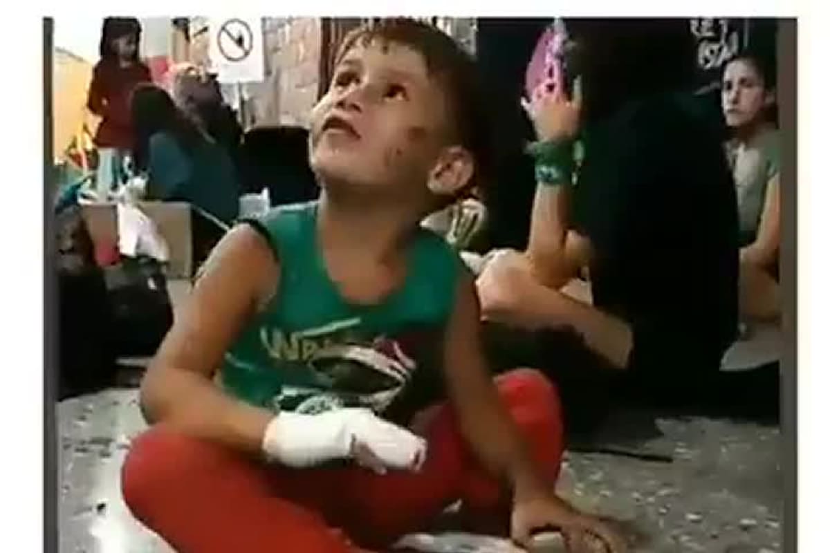 Lucio Dupuy, en diciembre de 2020, con su cara golpeada y un dedo fracturado