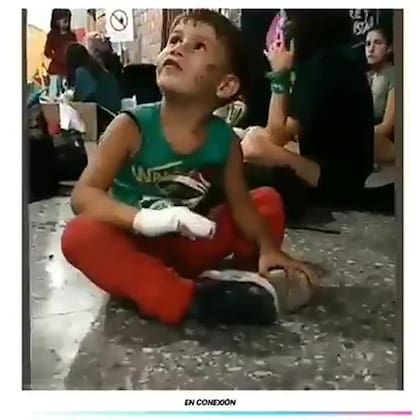 Lucio Dupuy, en diciembre de 2020, con su cara golpeada y un dedo fracturado