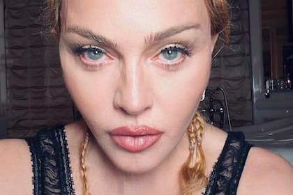 Madonna recurrió a sus redes sociales para hablar de su estado de salud