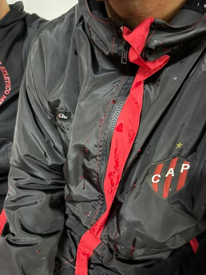 Manchas de sangre sobre la ropa de un jugador de Patronato