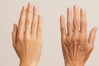 ¿Por qué siente hormigueo en las manos y cuándo debe consultar al médico?
