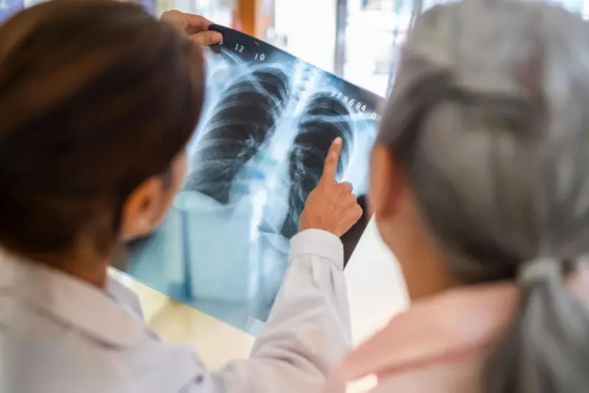 “Manteca verde”: el alimento que aporta beneficios extra para el corazón