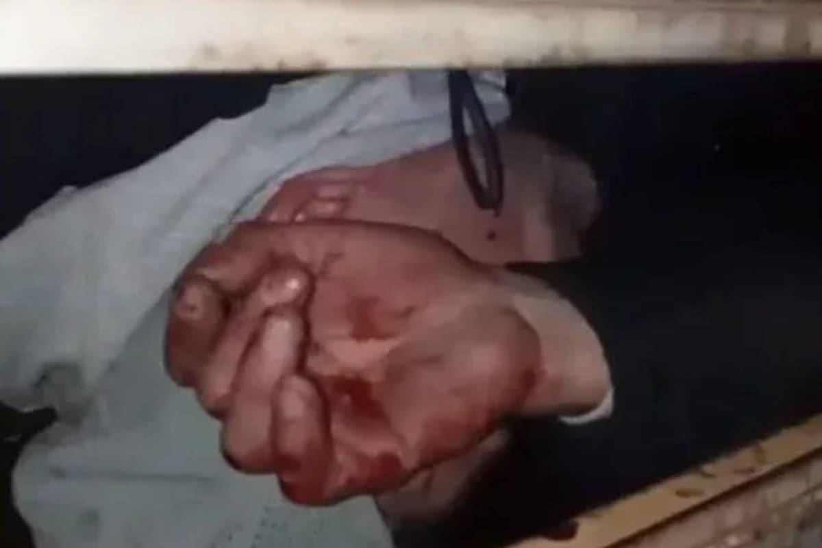 Mar del Plata: Quiso entrar a robar a una casa y quedó atrapado en la reja.