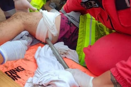 Mar del Plata: voló un sombrilla y terminó clavada en la pierna de un joven