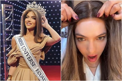 Mara Topic, ganadora de Miss Universo Ecuador, hizo público su diagnóstico de la enfermedad autoinmune de Hashimoto