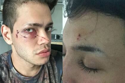 Marcos Zalazar y Franco de Bernardo fueron víctimas de un ataque homofóbico