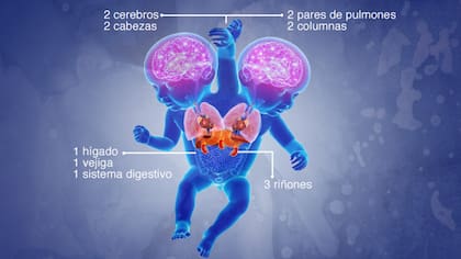 Marieme y Ndeye comparten algunos órganos importantes y también tienen sus propios órganos separados.