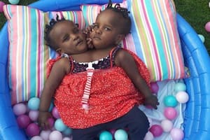 Marieme y Ndeye han desafiado las expectativas médicas y se han fortalecido.