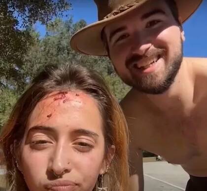 Marissa Carr, la joven que fue atacada, atribuye que el ataque no haya sido mayor a su máscara de esnórquel