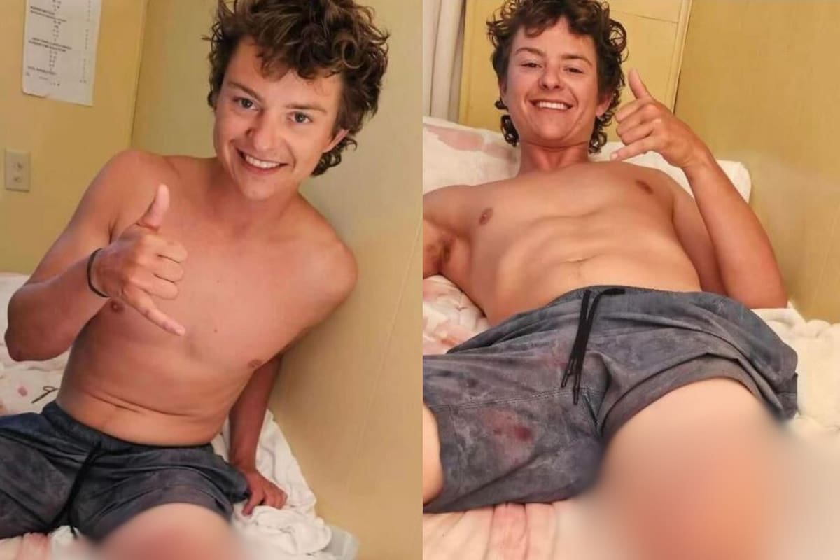 Marlin Wakeman sobrevivió el ataque de dos tiburones y dijo que las mordidas se sintieron como golpes de puño