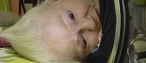 La historia de la última mujer con polio que murió en un cilindro de metal a los 78 años