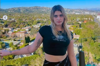 Martita Fort se hizo un retoque en la cara y mostró el resultado en redes