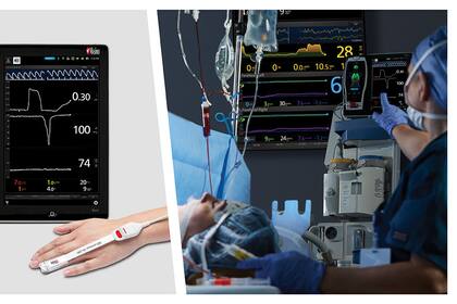 Masimo Root® with ORi™ (Photo: Business Wire)