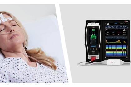 Masimo Root® with SedLine® Brain Function Monitoring (Photo: Business Wire)