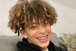 Mason Dark es un adolescente de 16 años que terminó con quemaduras graves luego de seguir un reto viral