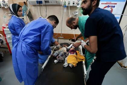 Médicos atienden a niños heridos en un bombardeo israelí en la Franja de Gaza, en un hospital en Deir Al-Balah, el miércoles 25 de octubre de 2023