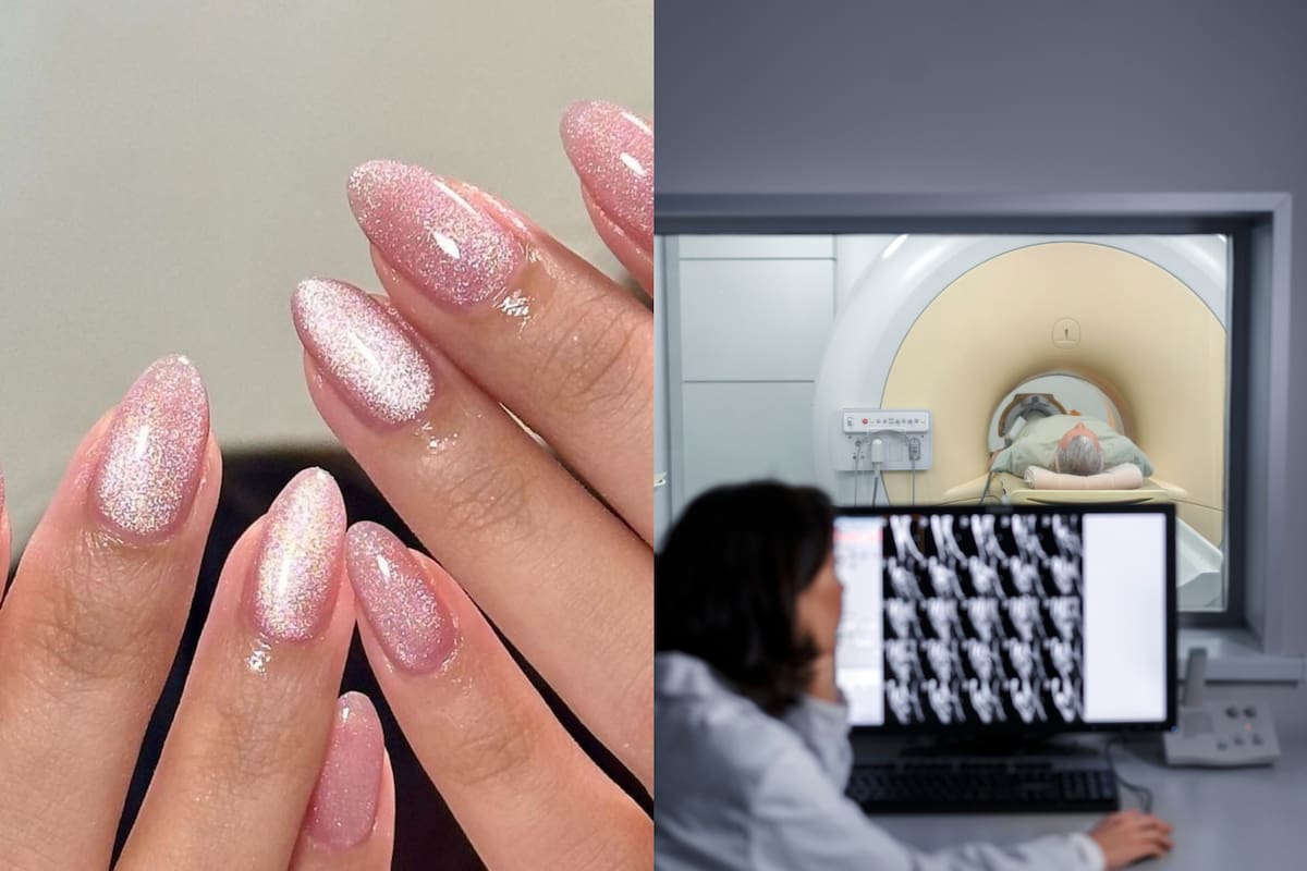 Médicos de Miami alertaron que estos esmaltes pueden interferir con resonancias magnéticas (MRI)