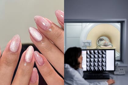 Médicos de Miami alertaron que estos esmaltes pueden interferir con resonancias magnéticas (MRI)