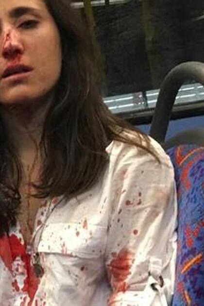 Melania Geymonat (der.) y Chris fueron atacadas en un autobús en Londres el 30 de mayo de 2019