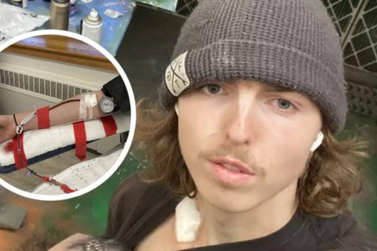 Menos de 24 horas después de que le insertaran un tubo en el corazón, el joven donante volvió a trabajar en una escultura para la escuela de arte