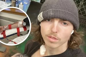 Menos de 24 horas después de que le insertaran un tubo en el corazón, el joven donante volvió a trabajar en una escultura para la escuela de arte