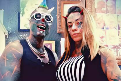 Michael se extirpó parte de la nariz