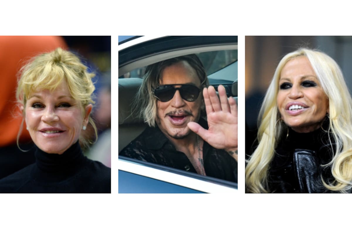 Mickey Rourke, Melanie Griffith y Donatella Versace, tres casos marcados por la obsesión al lifting
