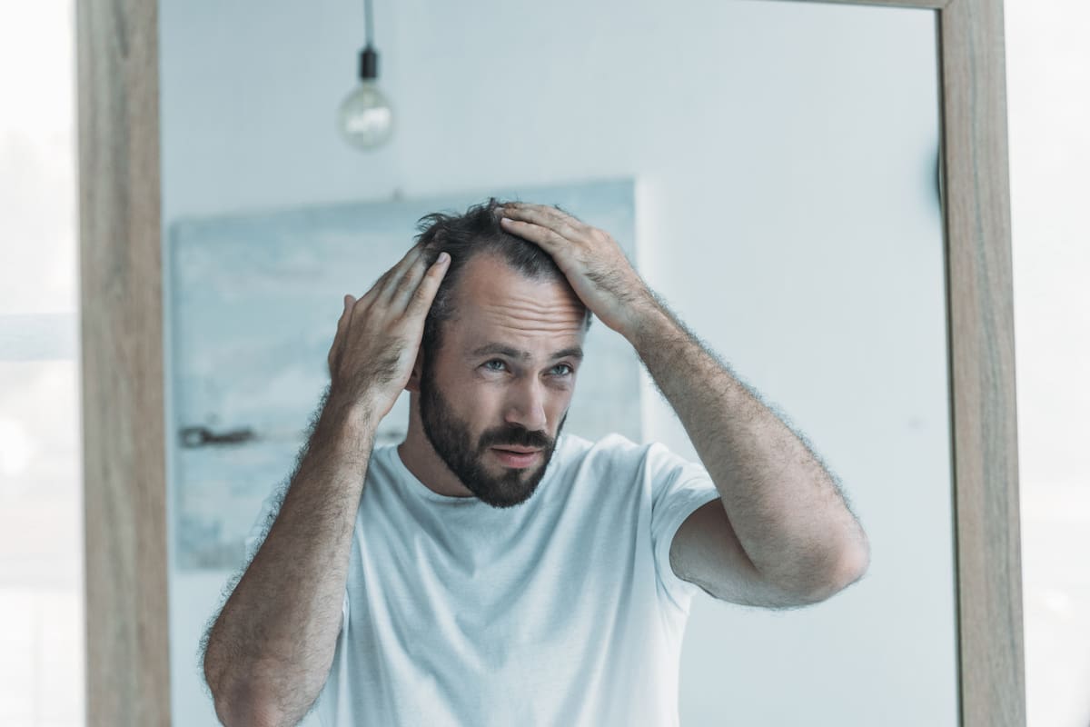 middle aged man with alopecia looking at mirror, hair loss concept