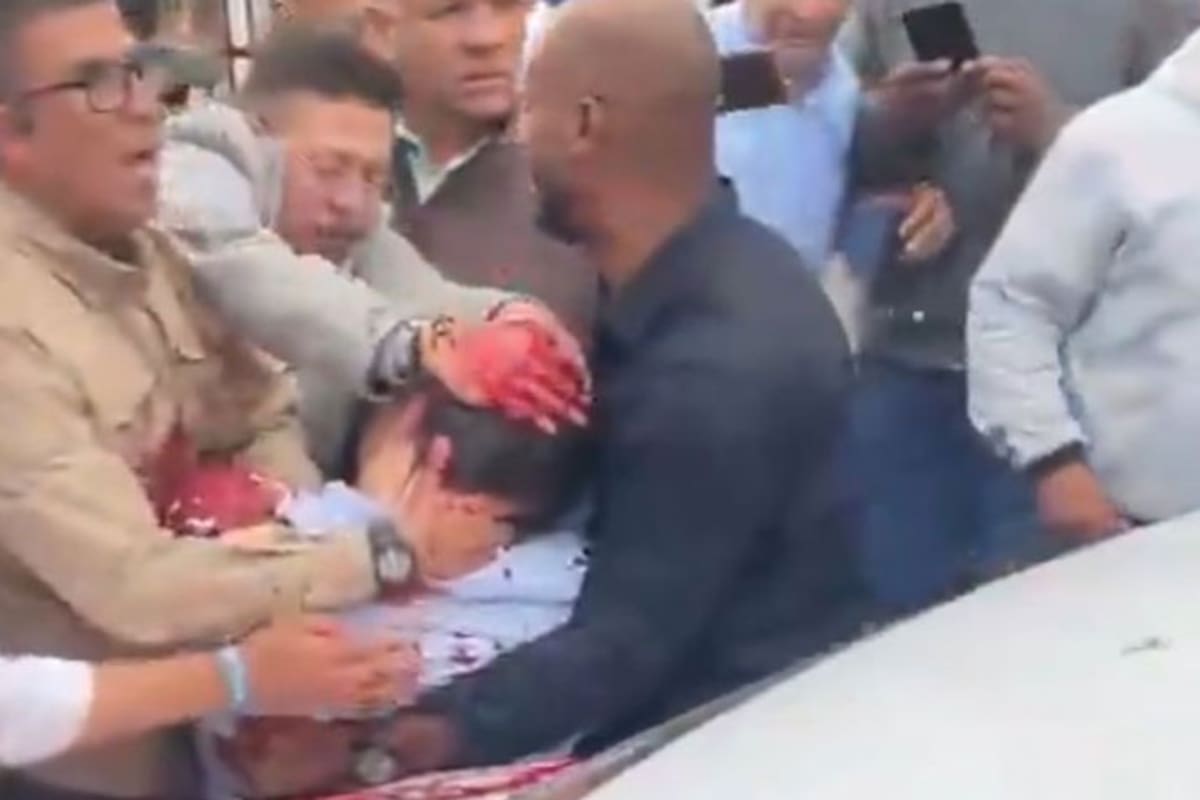 Miguel Uribe Turbay, tras el atentado