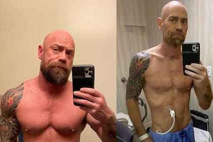 Mike Schultz, de 43 años, perdió 23 kilos durante su internación