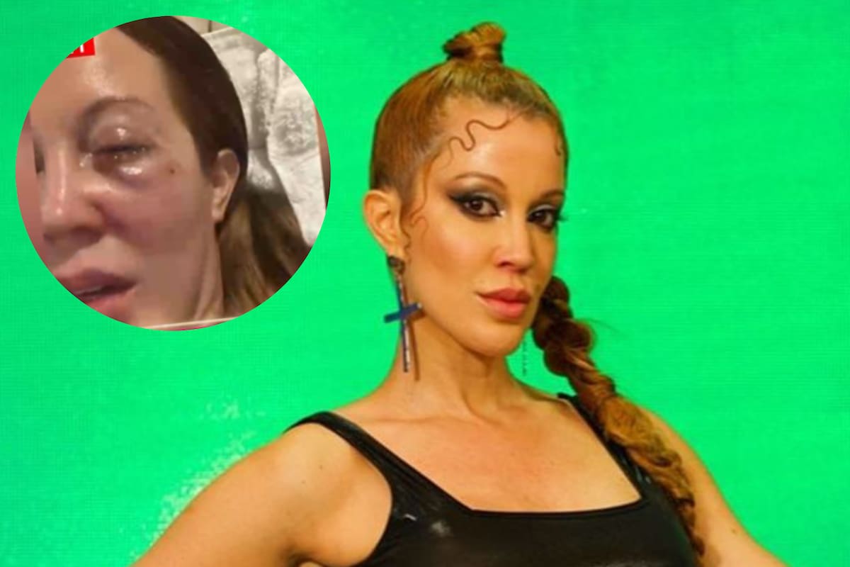 Miriam Lanzoni habló sobre el feroz ataque de su gato