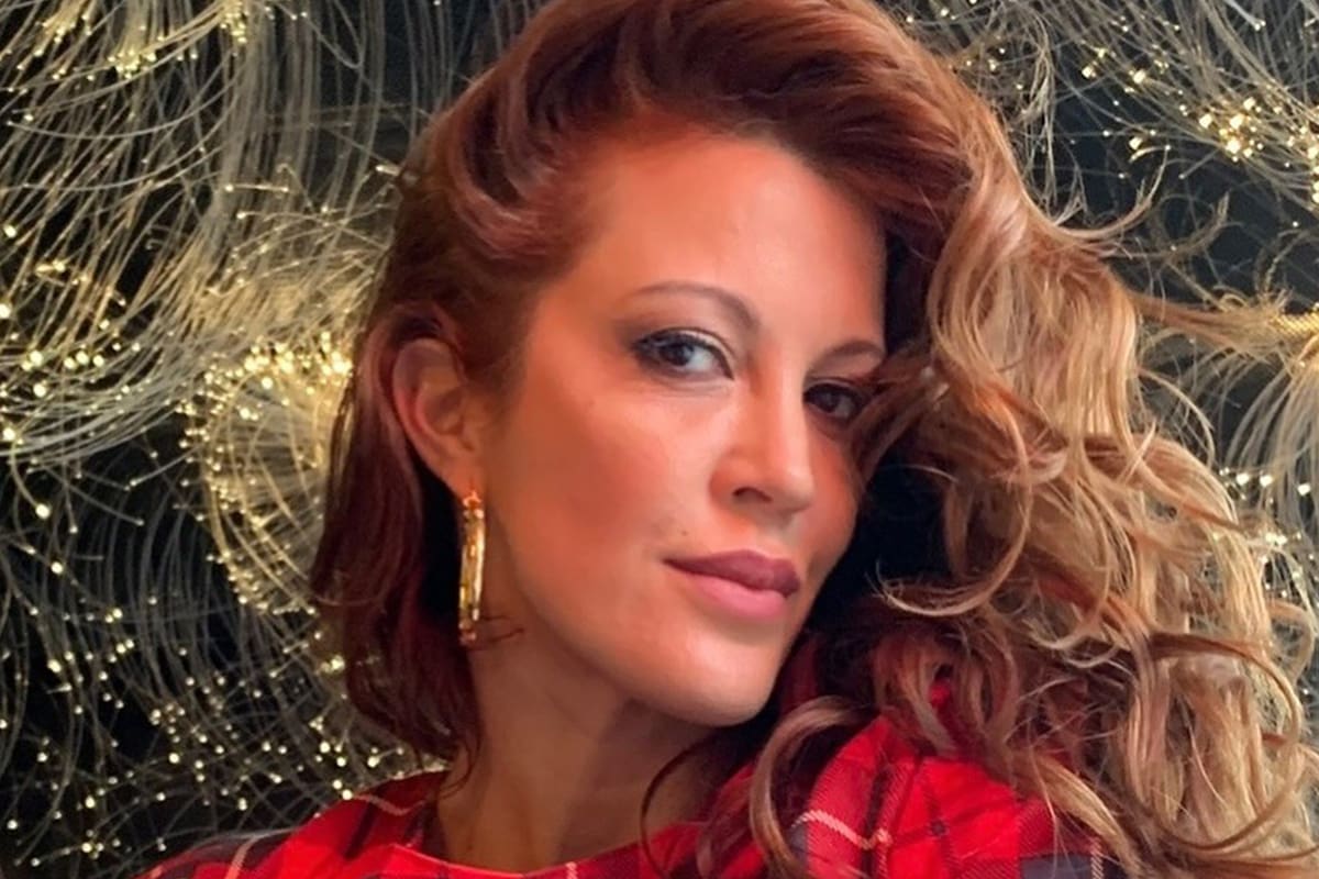 Miriam Lanzoni padeció psoriasis, enfermedad que la llevó a encerrarse en su casa durante meses. Hoy, deja la vergüenza atrás y está llena de proyectos