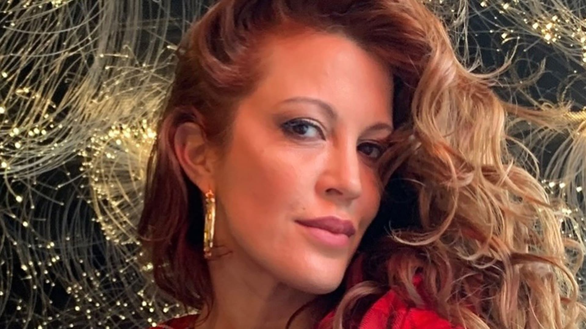 Miriam Lanzoni padeció psoriasis, enfermedad que la llevó a encerrarse en su casa durante meses. Hoy, deja la vergüenza atrás y está llena de proyectos