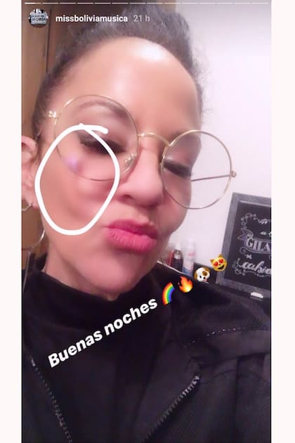 Miss Bolivia y las fotos de sus agresiones