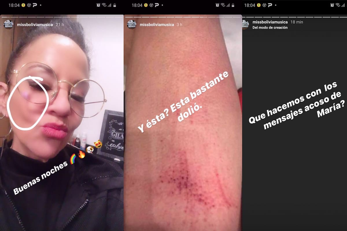 Miss Bolivia denuncia a su ex-pareja