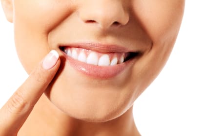 Mitos y verdades al blaquear los dientes