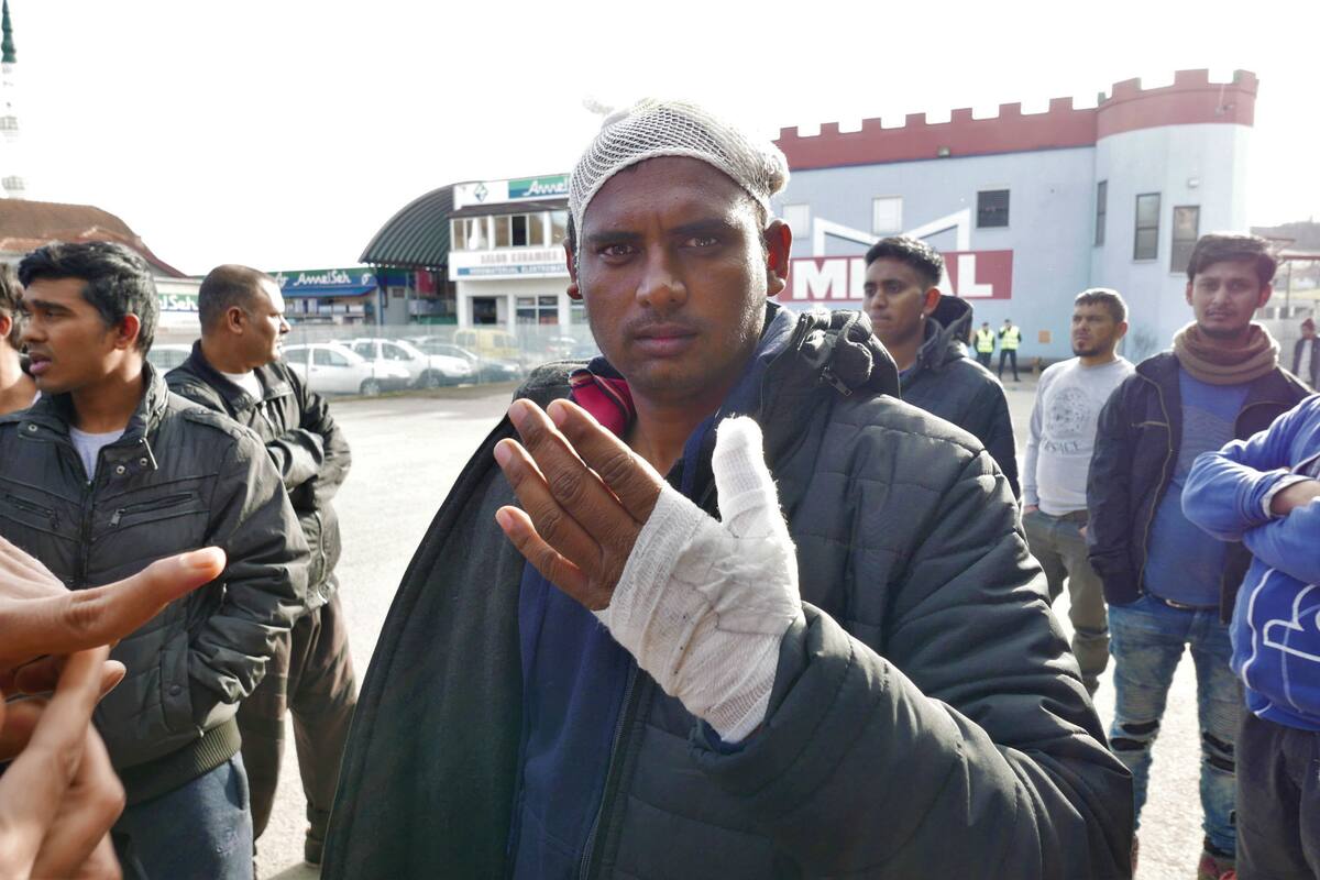 Mohamed, paquistaní de 30 años, muestra las heridas producto de la paliza de la policia