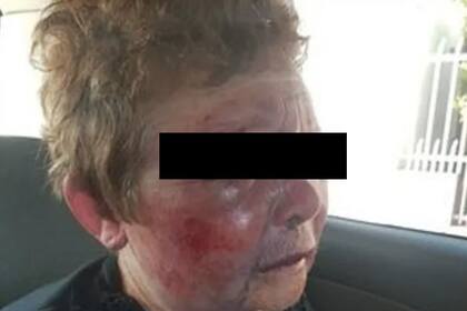 Momentos de terror son los que vivió el domingo una mujer de 73 años en Laferrere, tras ser golpeada sin piedad por ladrones en su propia casa
