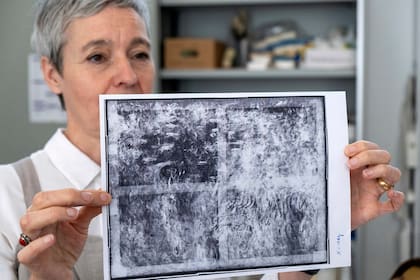 Hoppe con una radiografía que muestra a los nenúfares debajo de las glicinias